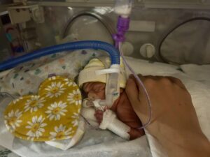 tiny nicu baby with tubes